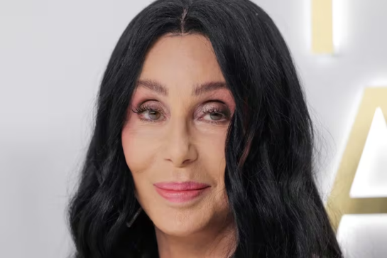 Cher confesó que odia envejecer: “Daría lo que fuera por volver a tener 70 años” 20 Cher Confeso Que Odia Envejecer Daria Lo Que Fuera Por Volver A Tener 70 Anos