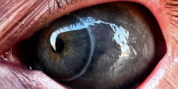 Galeria De Personas Con Los Ojos Tatuados