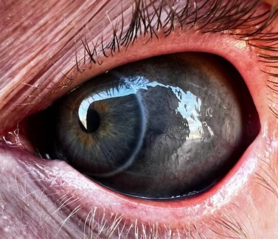 Galería de personas con los Ojos Tatuados... 1 Galeria De Personas Con Los Ojos Tatuados