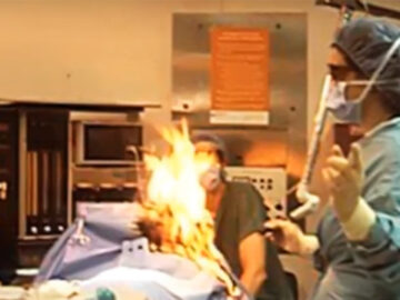 Una Mujer Provoco Un Incendio En El Quirofano Porque Se Le Escapo Un Pedo Mientras La Operaban Con Lazer