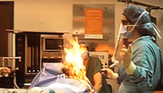 Una Mujer Provoco Un Incendio En El Quirofano Porque Se Le Escapo Un Pedo Mientras La Operaban Con Lazer