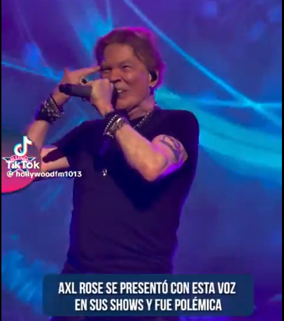 Imagina Pagar Mas De 200 Dolares Para Ir A Ver Cantar Asi A Axl Rose
