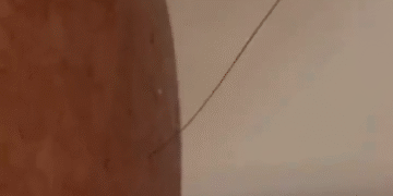 Cuidando Mi Ultimo Pelo Como Si Fuera De Oro