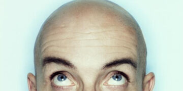 Llamar Calvo A Un Hombre Es Acoso Sexual Segun Un Tribunal De Reino Unido