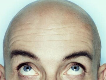 Llamar Calvo A Un Hombre Es Acoso Sexual Segun Un Tribunal De Reino Unido