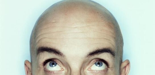 Llamar Calvo A Un Hombre Es Acoso Sexual Segun Un Tribunal De Reino Unido