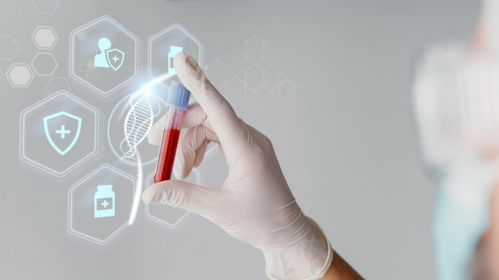 El Lupus finalmente tiene un claro culpable, es un virus común llevado por el 95% de nosotros 3 lupus - lupus