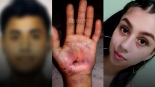 Informe de OIJ revela posible canibalismo y necrofagia en femicidio de Nadia Peraza. 5 Caso Nadia mano Buzano Paisano2 720x4051 1