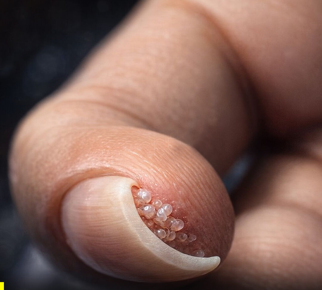 Riesgos del VPH en salones de belleza y como prevenir