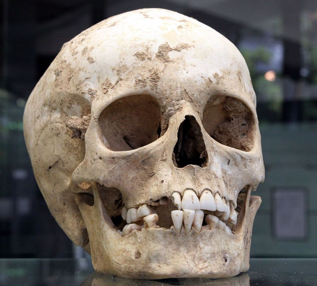 Así es cómo el sarro dental se ha convertido en una fuente de primer orden para reconstruir la historia de las poblaciones antiguas 7 Cráneo de Herxheim