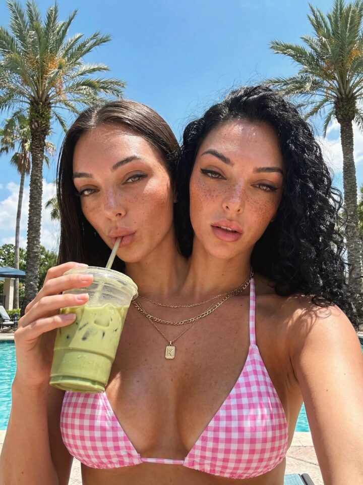 Las Gemelas Siamesas Valeria y Camila... 20 610640021 17847753075653872 7551478305931630172 n