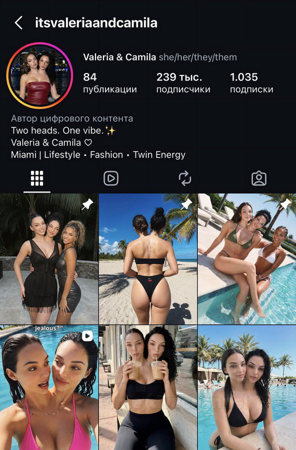 Las Gemelas Siamesas Valeria y Camila... 4 G dpFA4XEAAdZEe